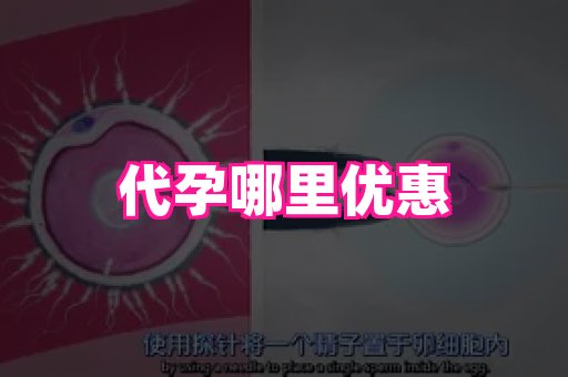 长沙助孕网站 1